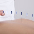 Finding a Reputable Acupuncturist: Your Guide to Pain Relief