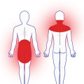 Understanding Neuropathic Pain