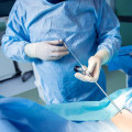 Understanding the Risks and Benefits of Surgery for Pain Relief