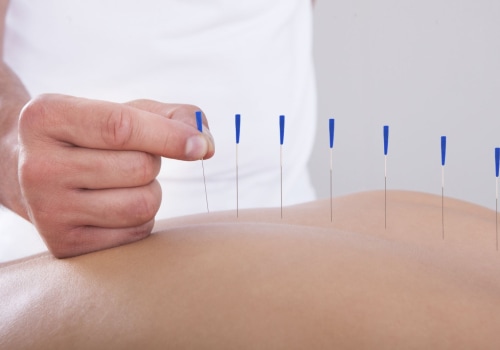 Finding a Reputable Acupuncturist: Your Guide to Pain Relief