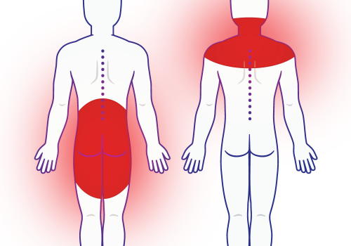 Understanding Neuropathic Pain